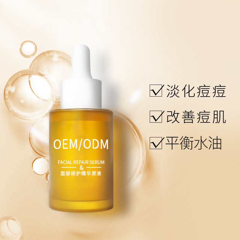 元朗区_祛痘精华原液OEM
